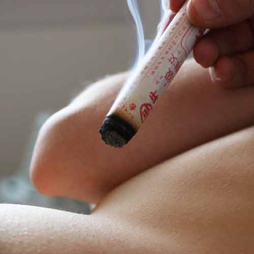 moxibustion toulouse